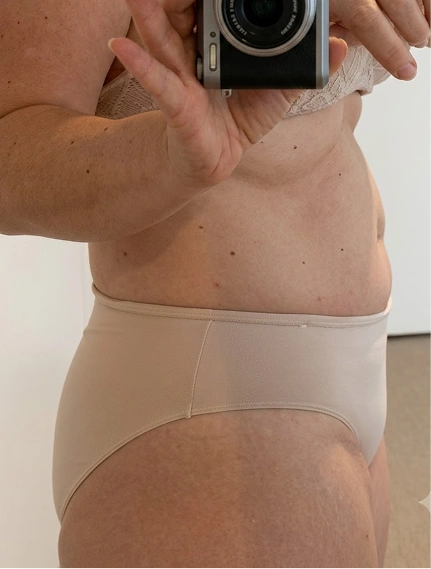condition after gut-brain essential