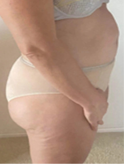 condition before gut-brain essential
